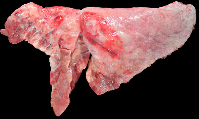 Ryc 5: Koinfekcja M. hyopneumoniae i A. pleuropneumoniae w płucach świń. Doczaszkowo-środkowe obszary konsolidacji o czerwono-brązowym zabarwieniu, wywołane zakażeniem M. hyopneumoniae oraz owalna zmiana ze zwł&oacute;knieniem opłucnej i krwotoczną okolicą w płacie przeponowym, odpowiadająca przewlekłemu stadium po powstaniu martwicy wywołanej przez A. pleuropneumoniae.
